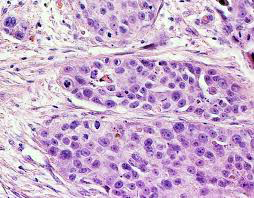Diagnóstico de Patología Ginecológica