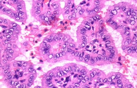 Estudio de Patología de Cabeza y Cuello